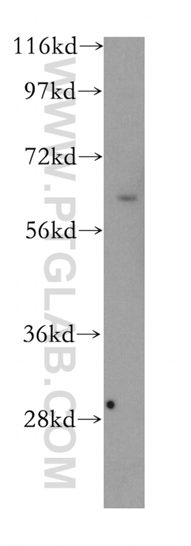 AF9 Antibody in Western Blot (WB)