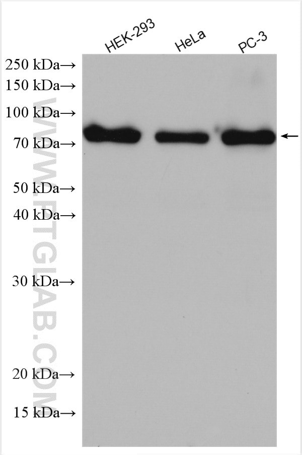 SUPV3L1 Antibody in Western Blot (WB)