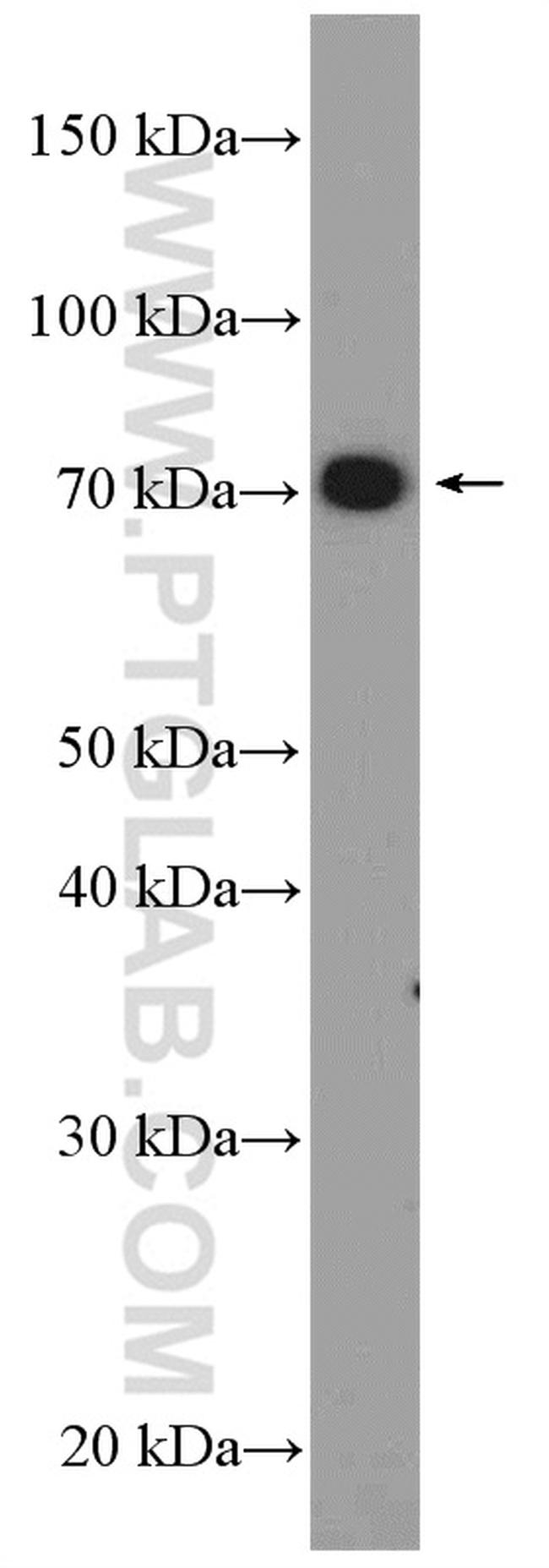 SUPV3L1 Antibody in Western Blot (WB)