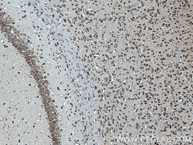 EXTL2 Antibody in Immunohistochemistry (Paraffin) (IHC (P))