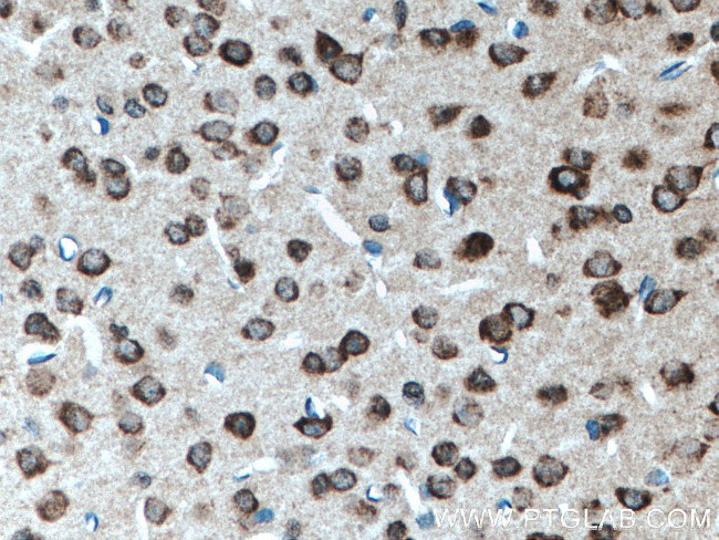 EXTL2 Antibody in Immunohistochemistry (Paraffin) (IHC (P))