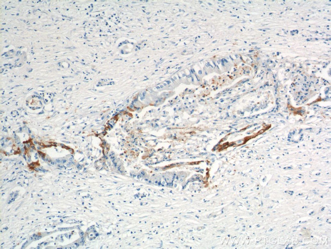 XK Antibody in Immunohistochemistry (Paraffin) (IHC (P))