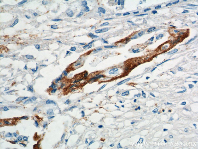 XK Antibody in Immunohistochemistry (Paraffin) (IHC (P))