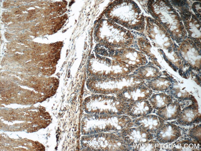 Alpha E catenin Antibody in Immunohistochemistry (Paraffin) (IHC (P))