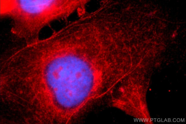 Alpha E catenin Antibody in Immunocytochemistry (ICC/IF)