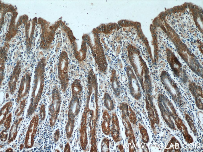 Alpha E catenin Antibody in Immunohistochemistry (Paraffin) (IHC (P))