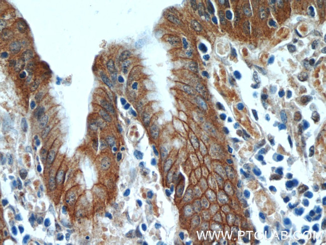 Alpha E catenin Antibody in Immunohistochemistry (Paraffin) (IHC (P))