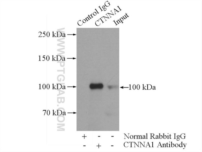 Alpha E catenin Antibody in Immunoprecipitation (IP)