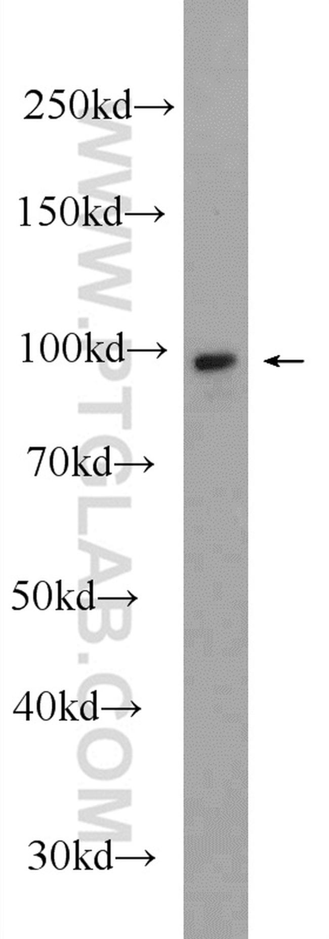 Alpha E catenin Antibody in Western Blot (WB)