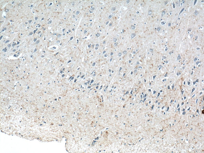 Neuropeptide Y Antibody in Immunohistochemistry (Paraffin) (IHC (P))