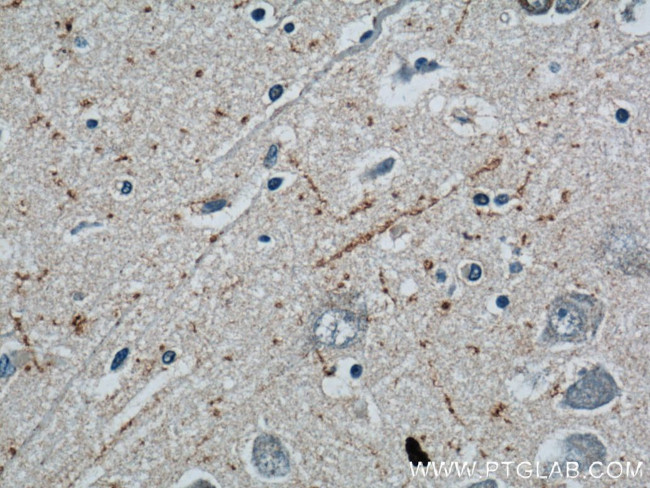 Neuropeptide Y Antibody in Immunohistochemistry (Paraffin) (IHC (P))