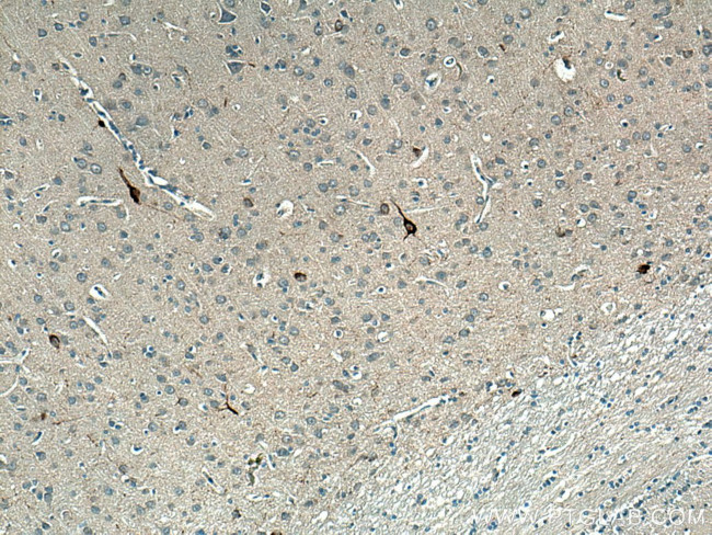 Neuropeptide Y Antibody in Immunohistochemistry (Paraffin) (IHC (P))