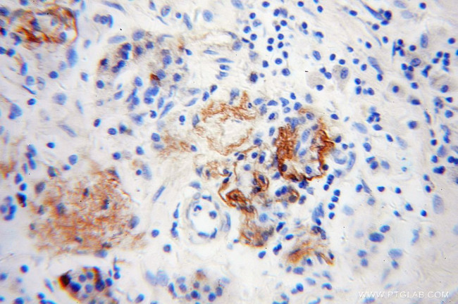 Neuropeptide Y Antibody in Immunohistochemistry (Paraffin) (IHC (P))