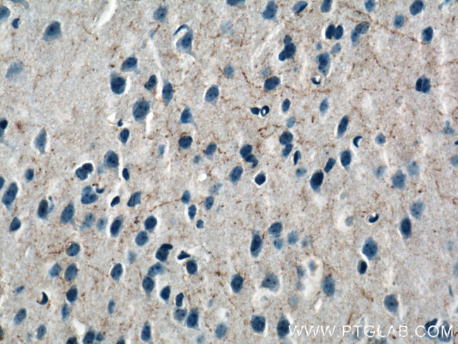 Neuropeptide Y Antibody in Immunohistochemistry (Paraffin) (IHC (P))