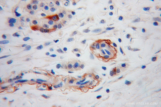 Neuropeptide Y Antibody in Immunohistochemistry (Paraffin) (IHC (P))