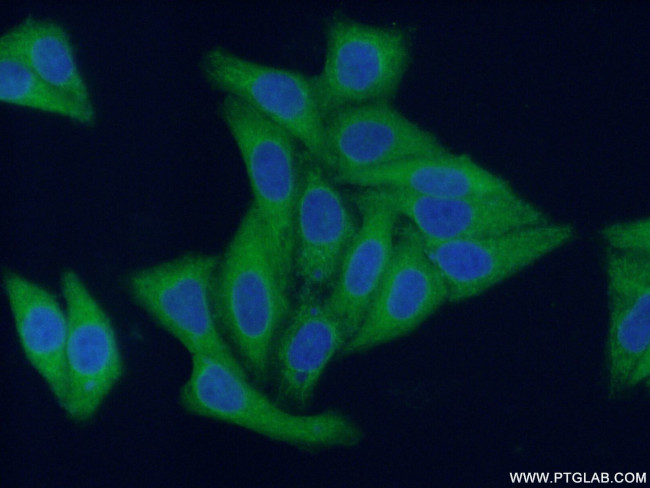 HDAC6 Antibody in Immunocytochemistry (ICC/IF)