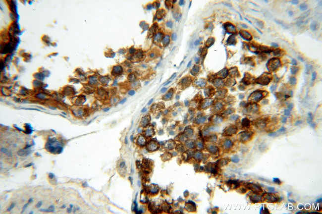 HDAC6 Antibody in Immunohistochemistry (Paraffin) (IHC (P))