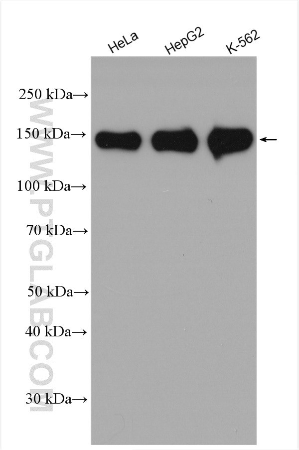 HDAC6 Antibody in Western Blot (WB)