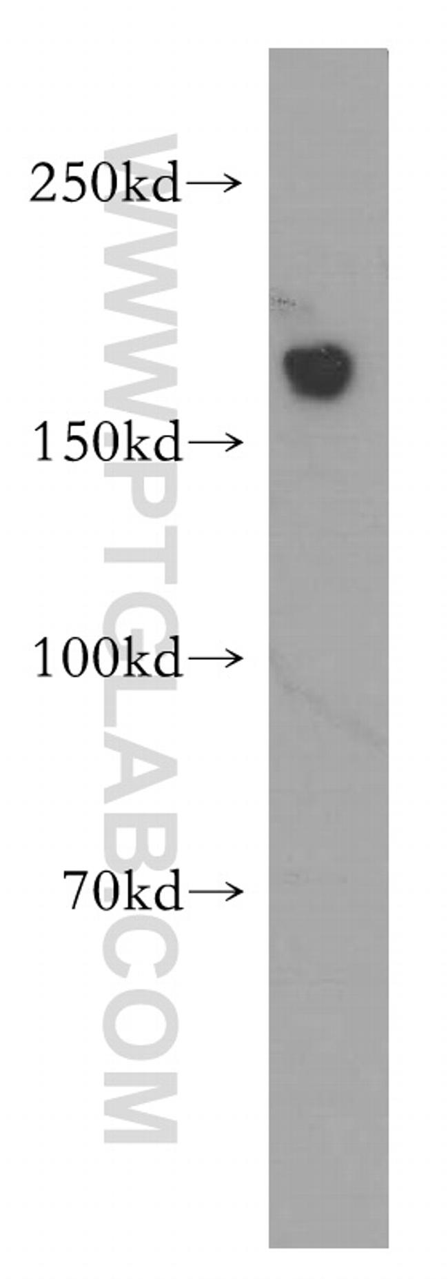 HDAC6 Antibody in Western Blot (WB)