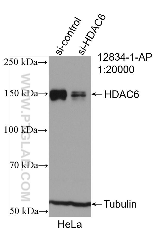 HDAC6 Antibody in Western Blot (WB)