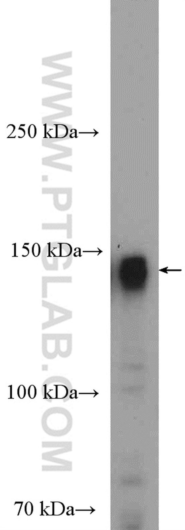 HDAC6 Antibody in Western Blot (WB)