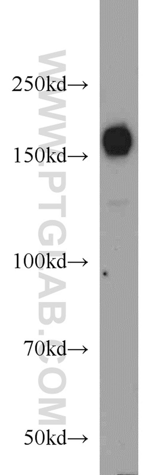 HDAC6 Antibody in Western Blot (WB)