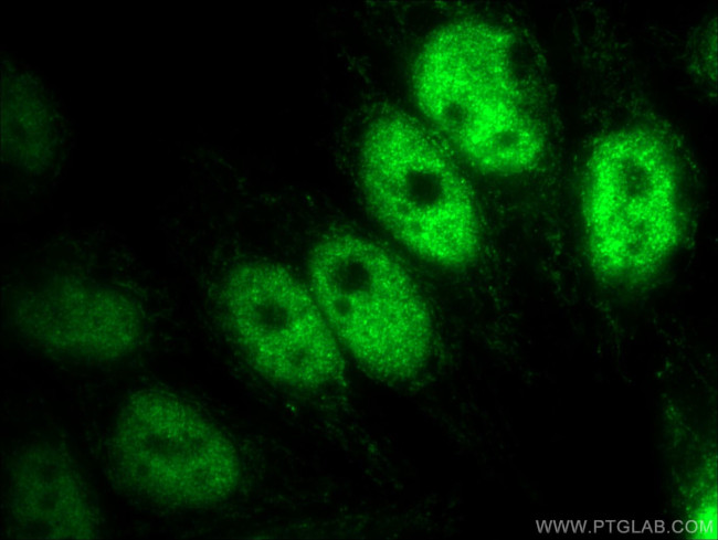 KDM3A/JMJD1A Antibody in Immunocytochemistry (ICC/IF)