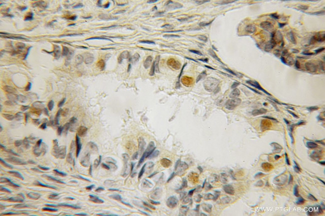 KDM3A/JMJD1A Antibody in Immunohistochemistry (Paraffin) (IHC (P))