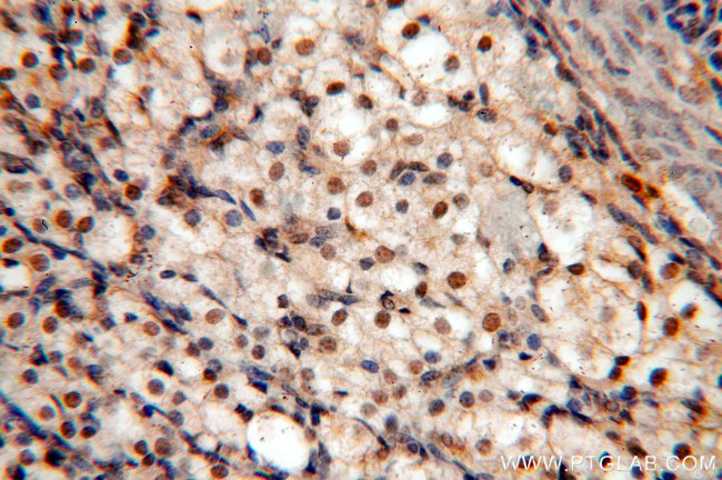 KDM3A/JMJD1A Antibody in Immunohistochemistry (Paraffin) (IHC (P))