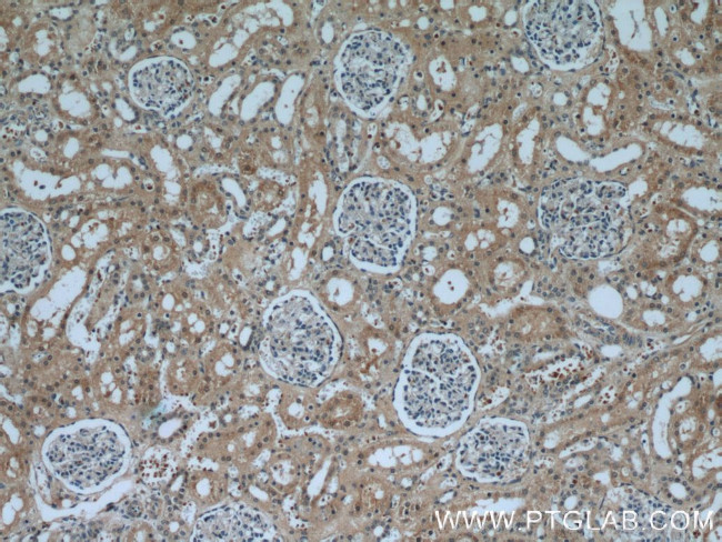 KDM3A/JMJD1A Antibody in Immunohistochemistry (Paraffin) (IHC (P))