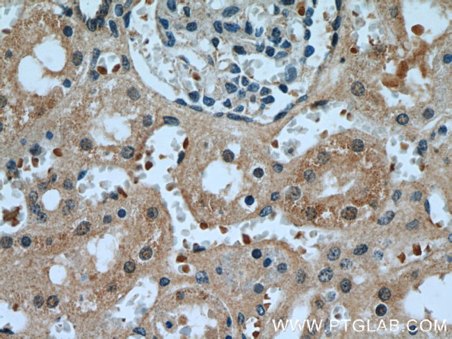 KDM3A/JMJD1A Antibody in Immunohistochemistry (Paraffin) (IHC (P))