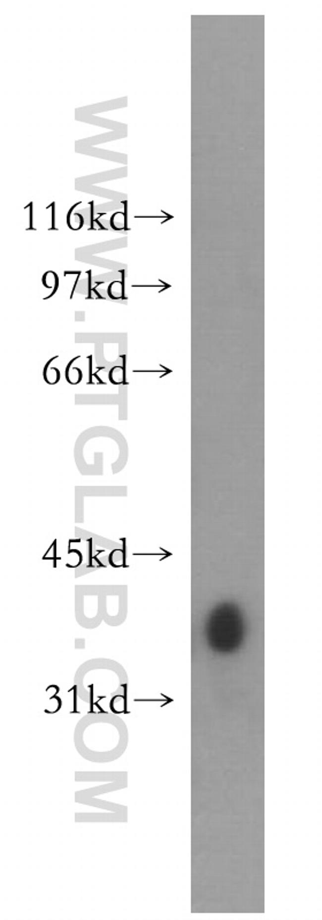 GYG1 Antibody in Western Blot (WB)