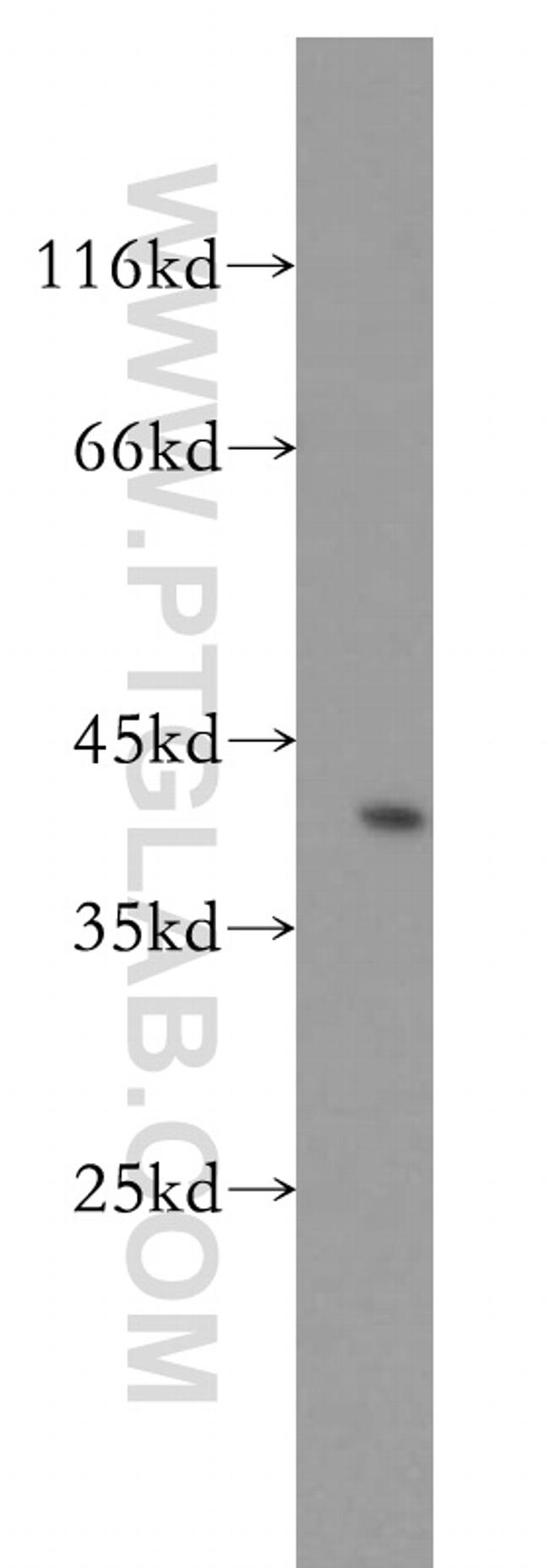 GYG1 Antibody in Western Blot (WB)