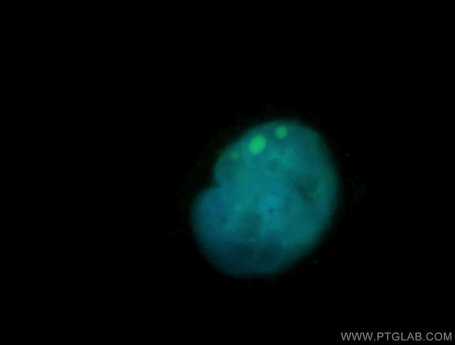 SMARCD3 Antibody in Immunocytochemistry (ICC/IF)