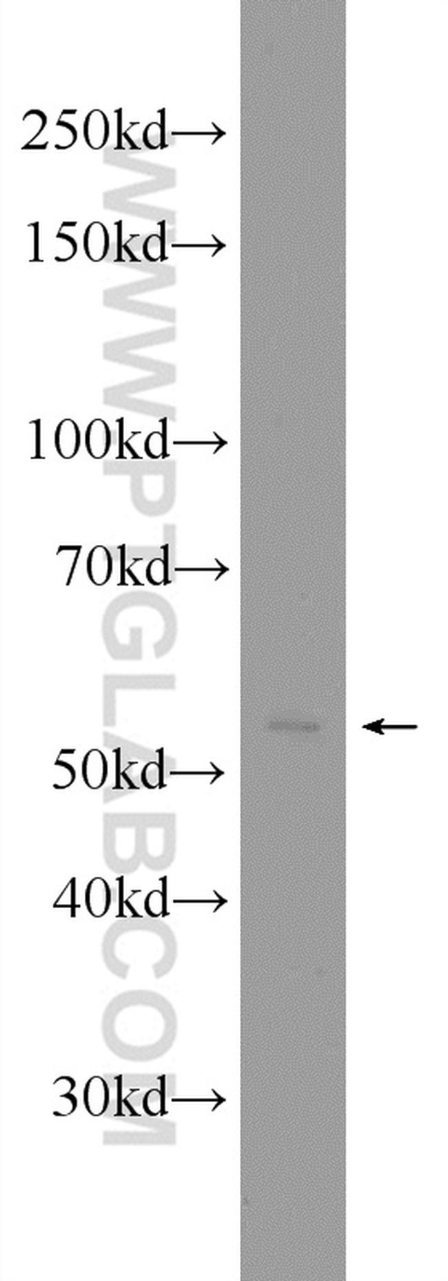 SMARCD3 Antibody in Western Blot (WB)