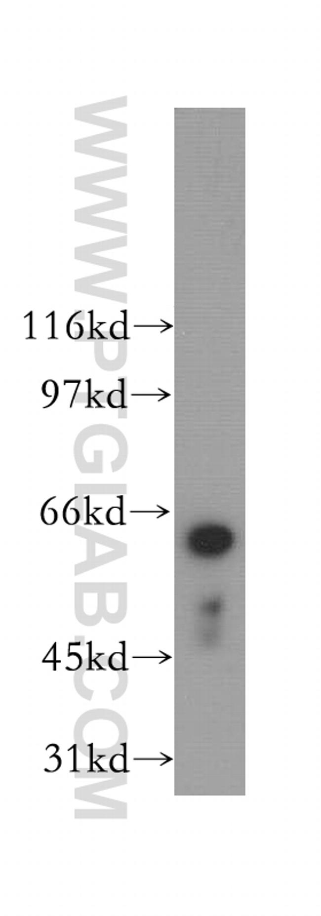 LGTN Antibody in Western Blot (WB)