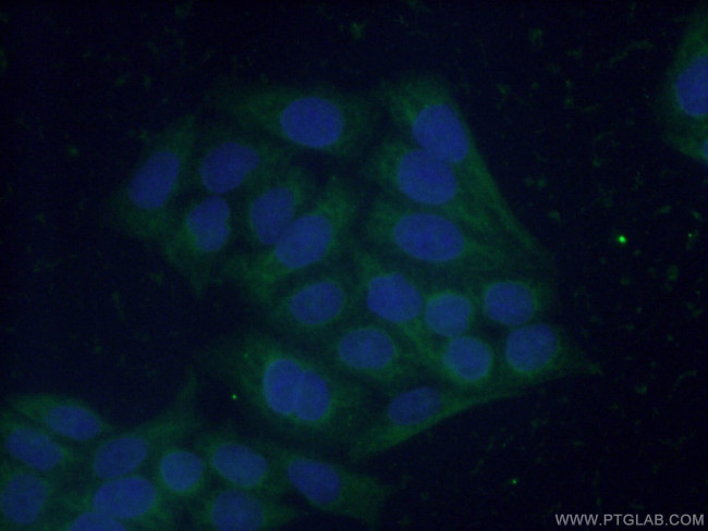 FBP1 Antibody in Immunocytochemistry (ICC/IF)