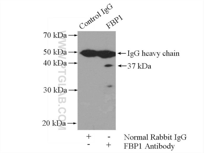 FBP1 Antibody in Immunoprecipitation (IP)