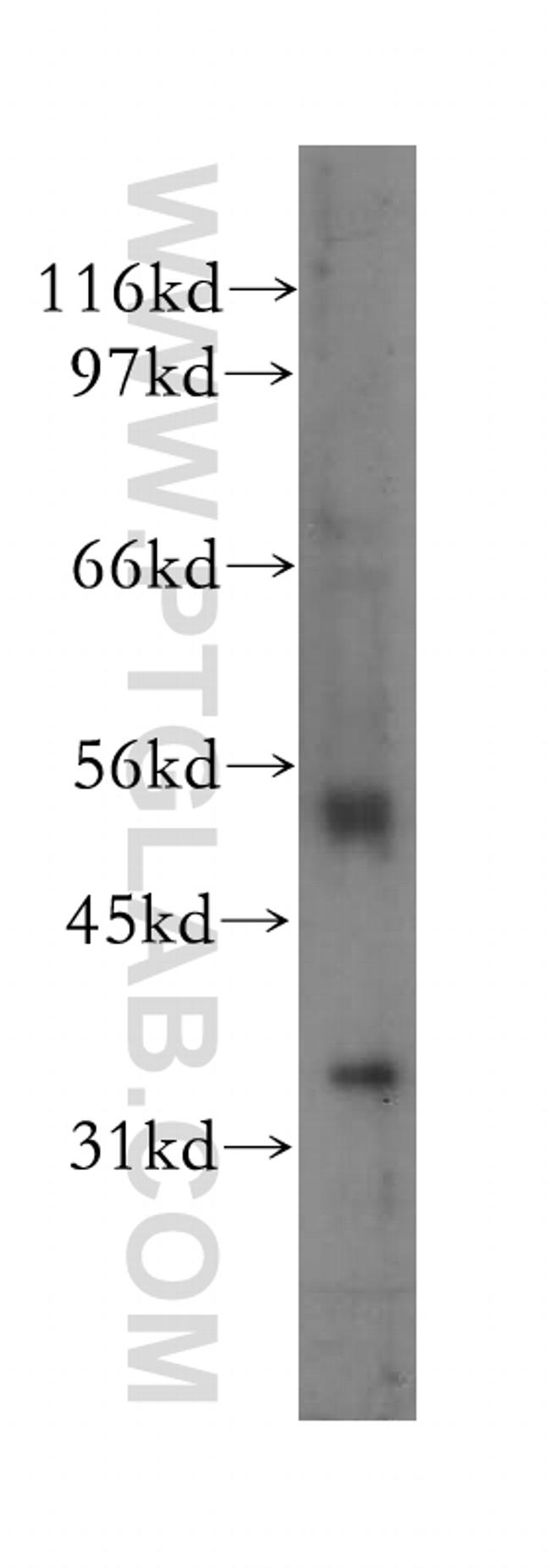 FBP1 Antibody in Western Blot (WB)