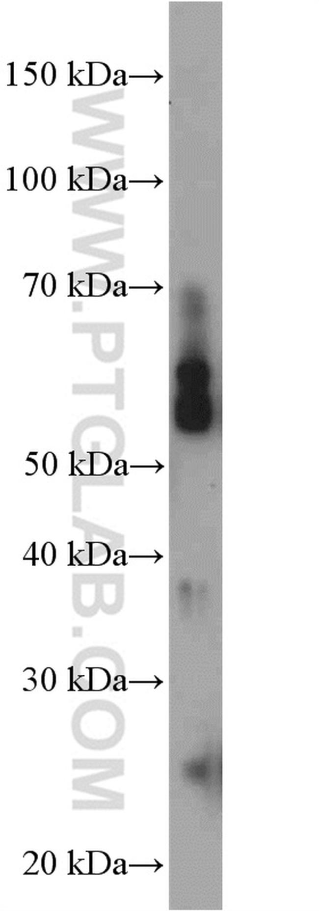 NEK3 Antibody in Western Blot (WB)