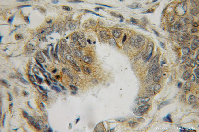 Galectin 2 Antibody in Immunohistochemistry (Paraffin) (IHC (P))