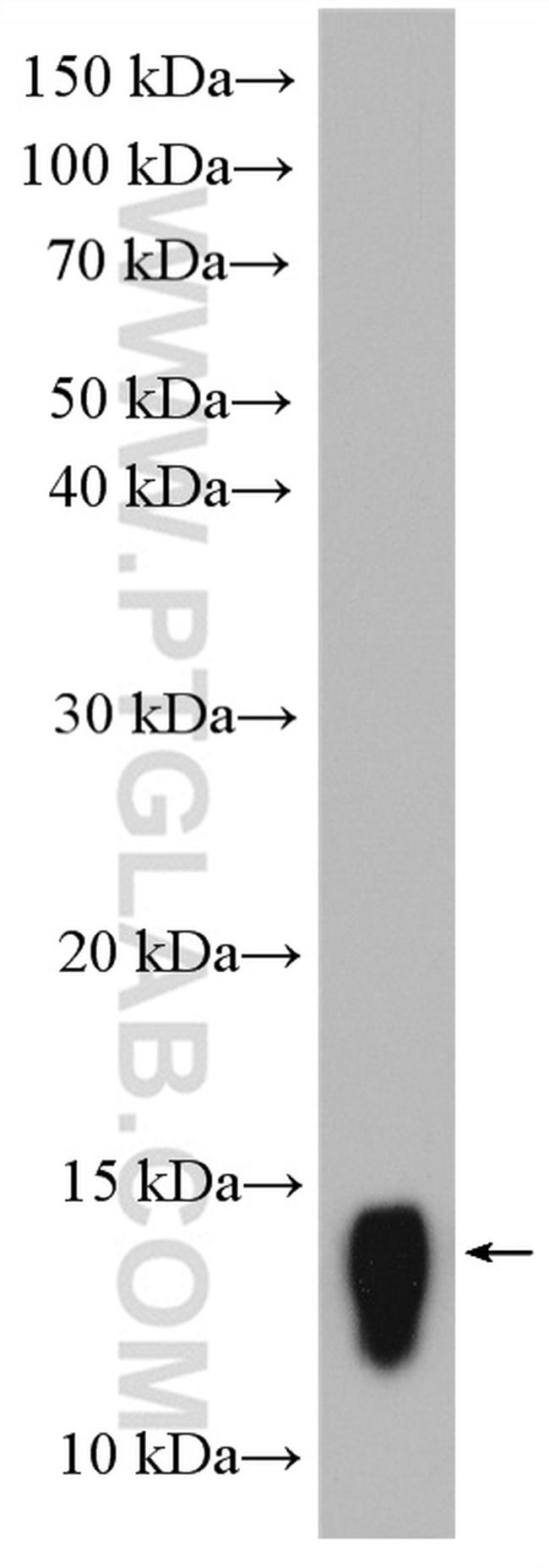 Galectin 2 Antibody in Western Blot (WB)