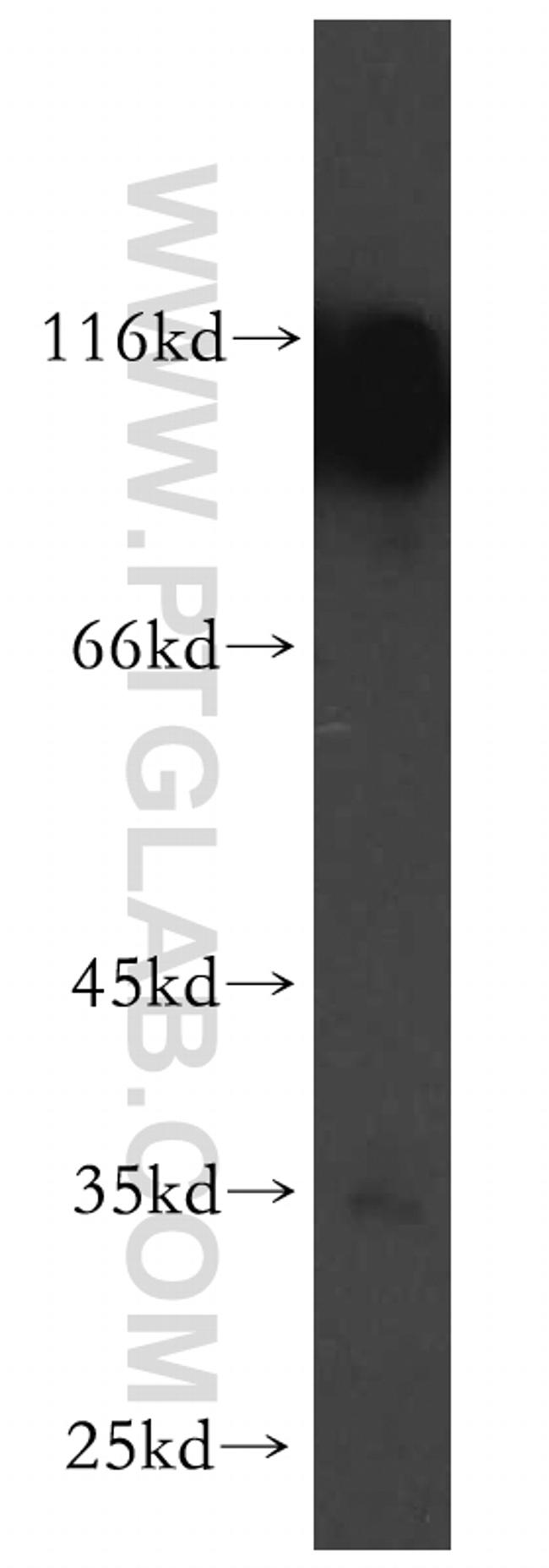 PCDHA6 Antibody in Western Blot (WB)