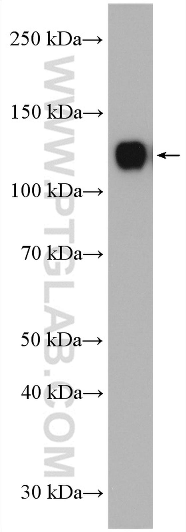 PCDHA6 Antibody in Western Blot (WB)