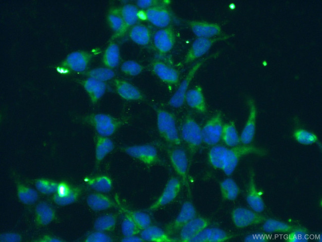 KGA/GAC Antibody in Immunocytochemistry (ICC/IF)