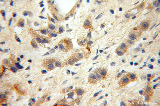 KGA/GAC Antibody in Immunohistochemistry (Paraffin) (IHC (P))