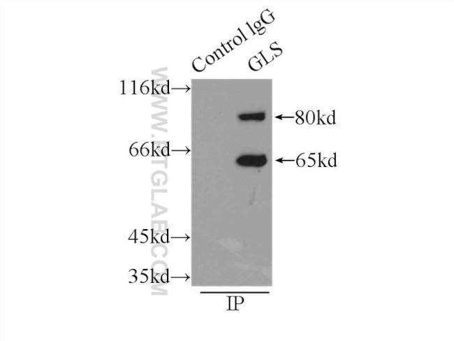 KGA/GAC Antibody in Immunoprecipitation (IP)