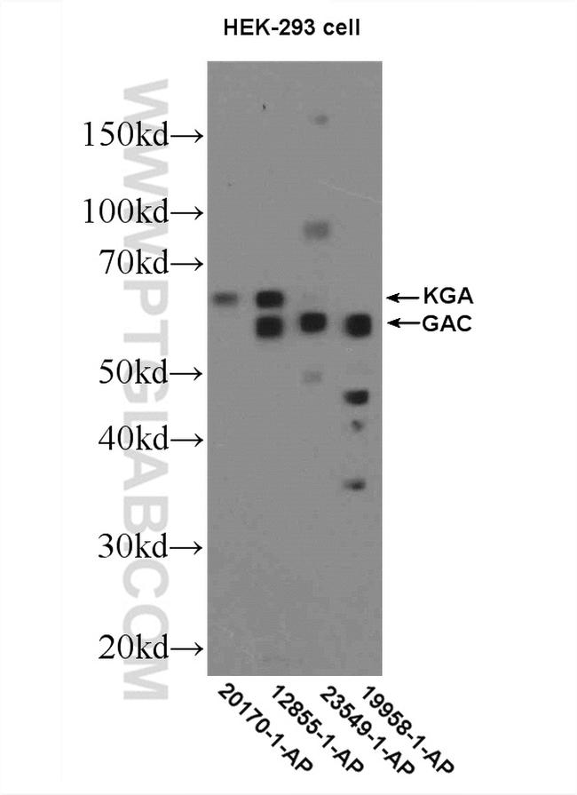 KGA/GAC Antibody in Western Blot (WB)