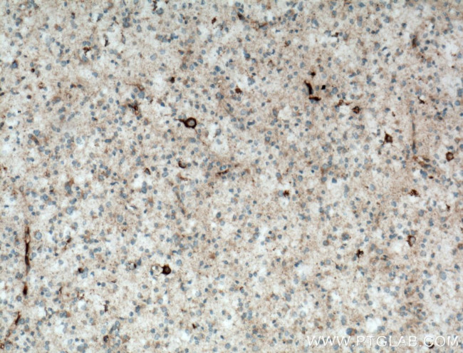 KGA/GAC Antibody in Immunohistochemistry (Paraffin) (IHC (P))