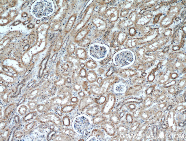 KGA/GAC Antibody in Immunohistochemistry (Paraffin) (IHC (P))